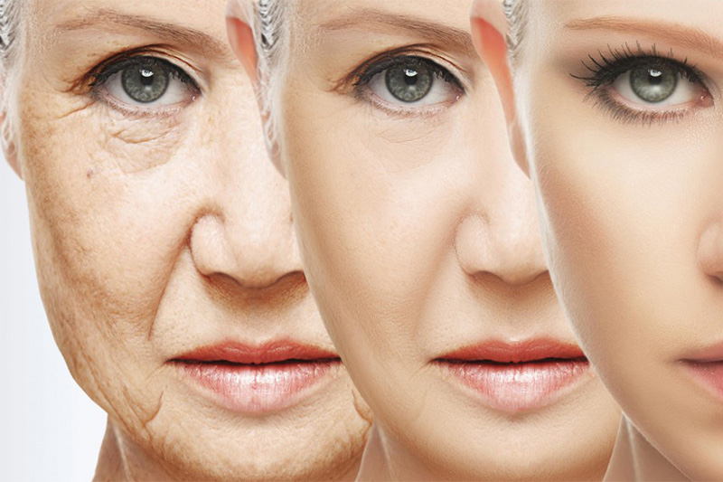 عوامل مؤثر در پیری پوست