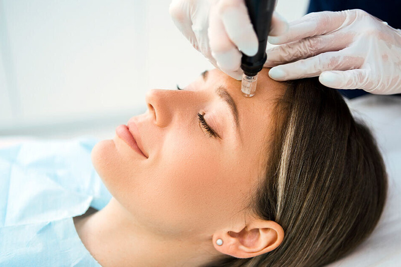 تعداد جلسات مزوتراپی