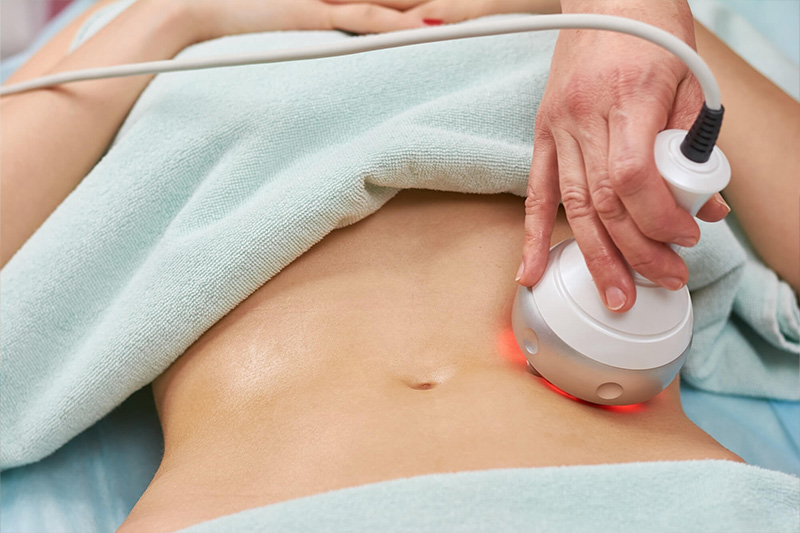 کاربرد دستگاه هایفو Ultrashape؛ هایفو اولتراشیپ چطور کار میکند؟