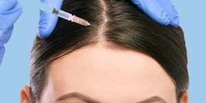 درمان ریزش مو با مزوتراپی مو + فواید روش نوین مزوتراپی مو