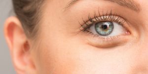 درمان پف زیر چشم با لیزر