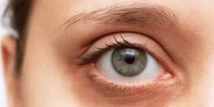 کاربرد لیزر برای دور چشم چیست؟