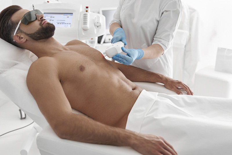 اقدامات مهم قبل از لیزر موهای زائد آقایان