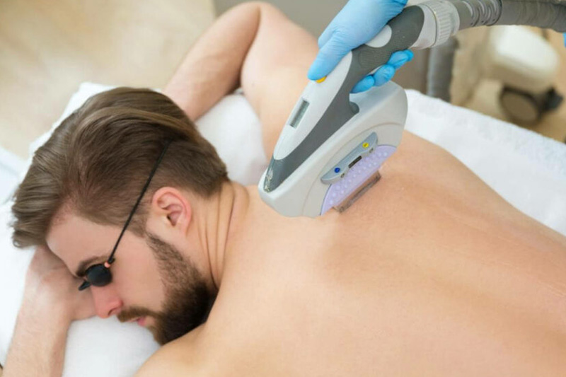 لیزر بدن مردان؛ لیزر موهای ناحیه تناسلی مردان چه عوارضی دارد؟
