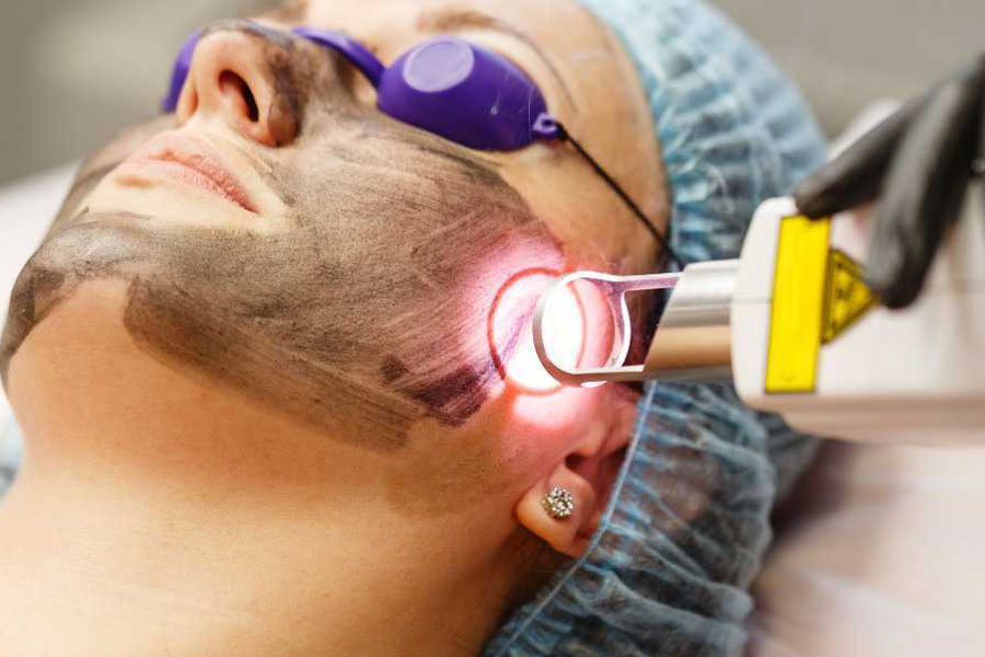 لیزرهای روشن کننده پوست و تاثیر آن ها بر روشن شدن پوست