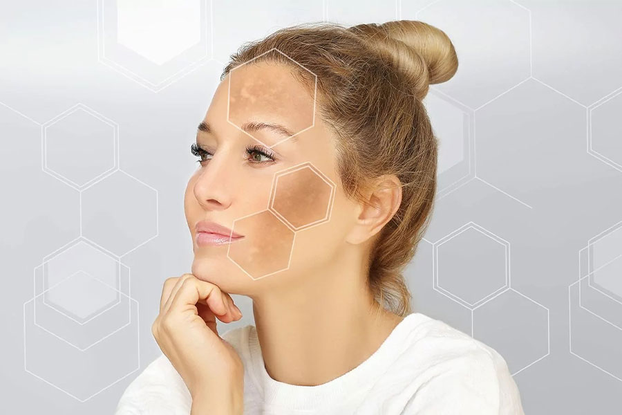 تاثیر لیزر بر روشن شدن پوست