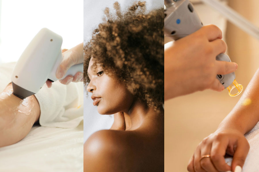 تاثیر تعداد فلش دستگاه بر نتیجه لیزر مو: نوع پوست و مو